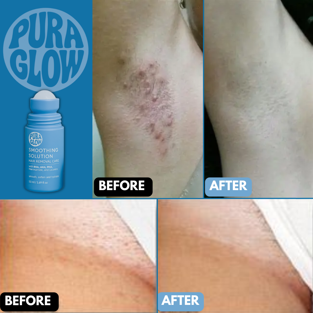 Pura Glow Smoothing Solution