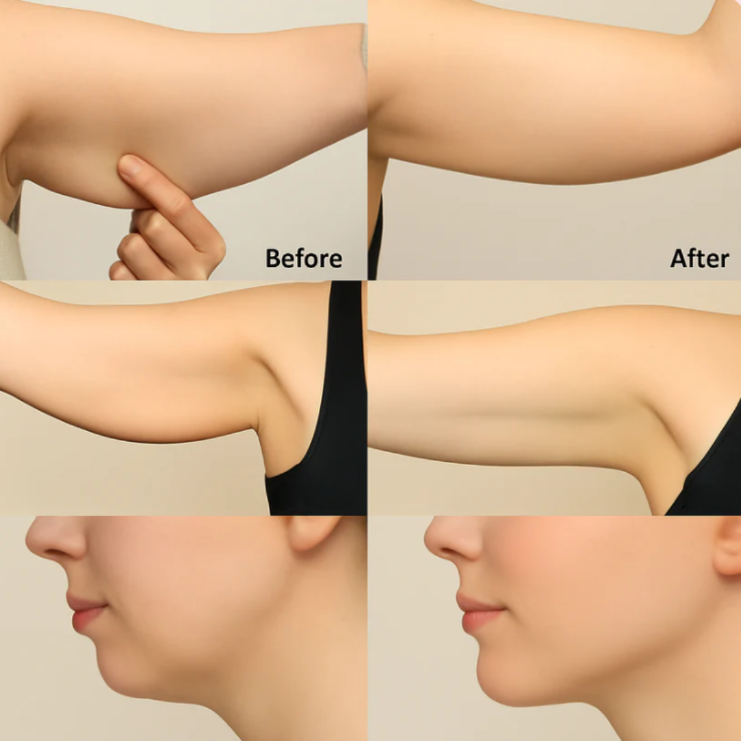 Vitalyn Lymphatic Drainage Herbal Extract