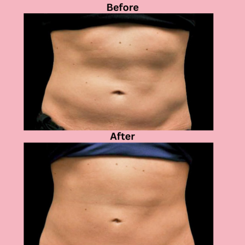 Pura Glow Roll-On Castor Oil